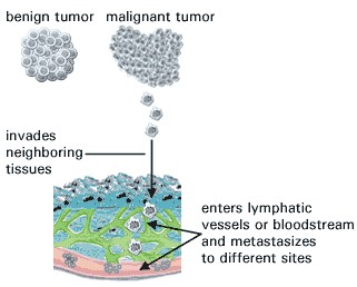 a malignant tumor will invade neighboring tissues and enter lymphatis vessels or bloodstream and metastasize to different sites